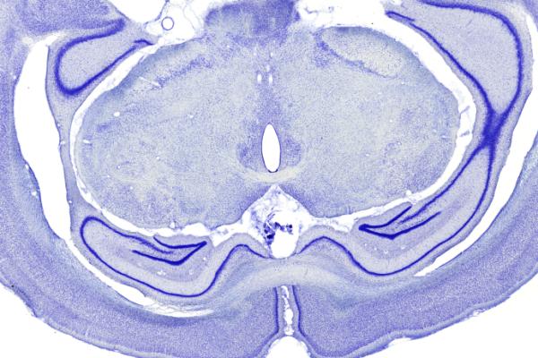 Brain image under the microscope